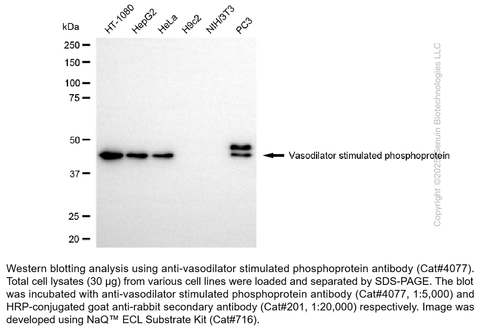 Anti-Vasodilator stimulated phosphoprotein Rabbit Monoclonal Ab #4077