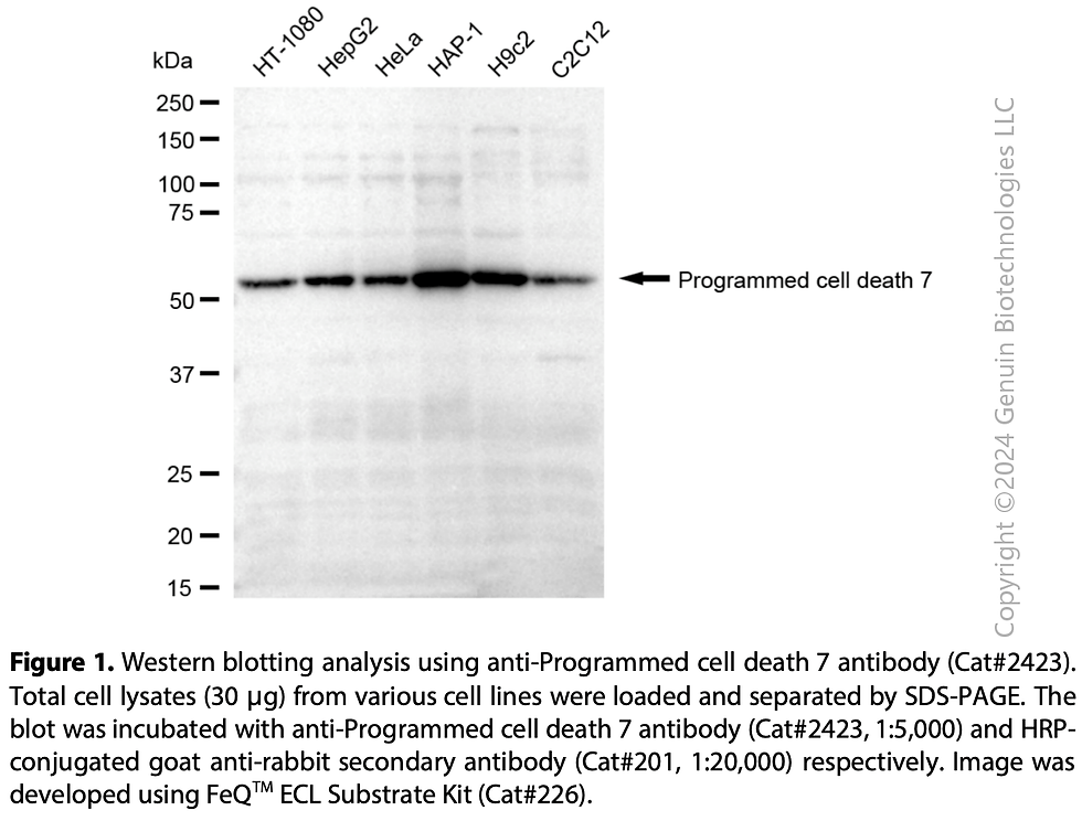 Thumbnail: Anti-Programmed Cell Death 7 Rabbit mAb #2423