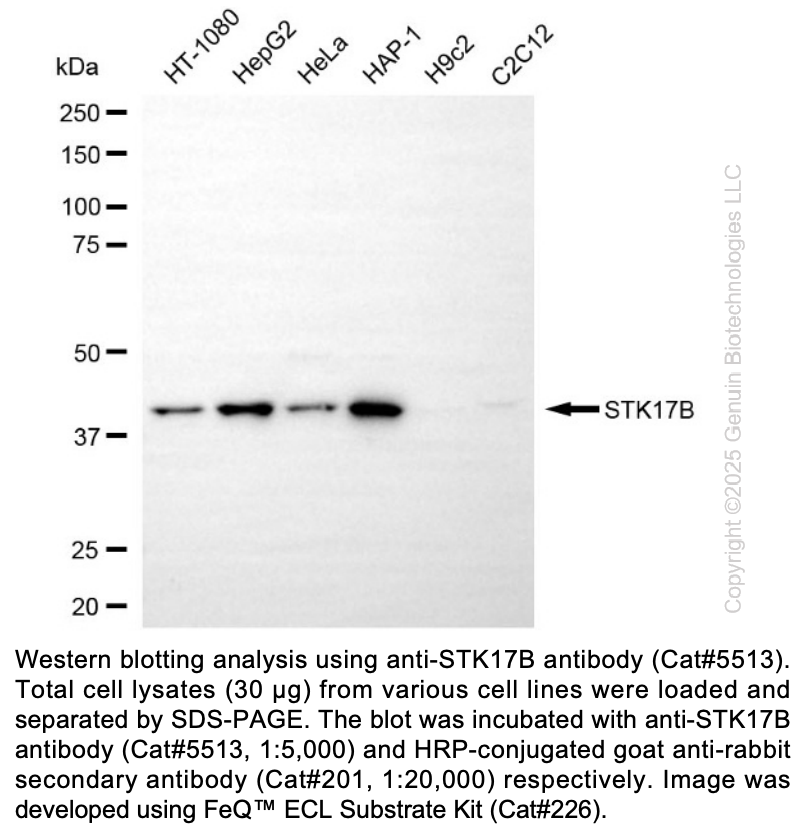 Anti-STK17B Rabbit mAb #5513