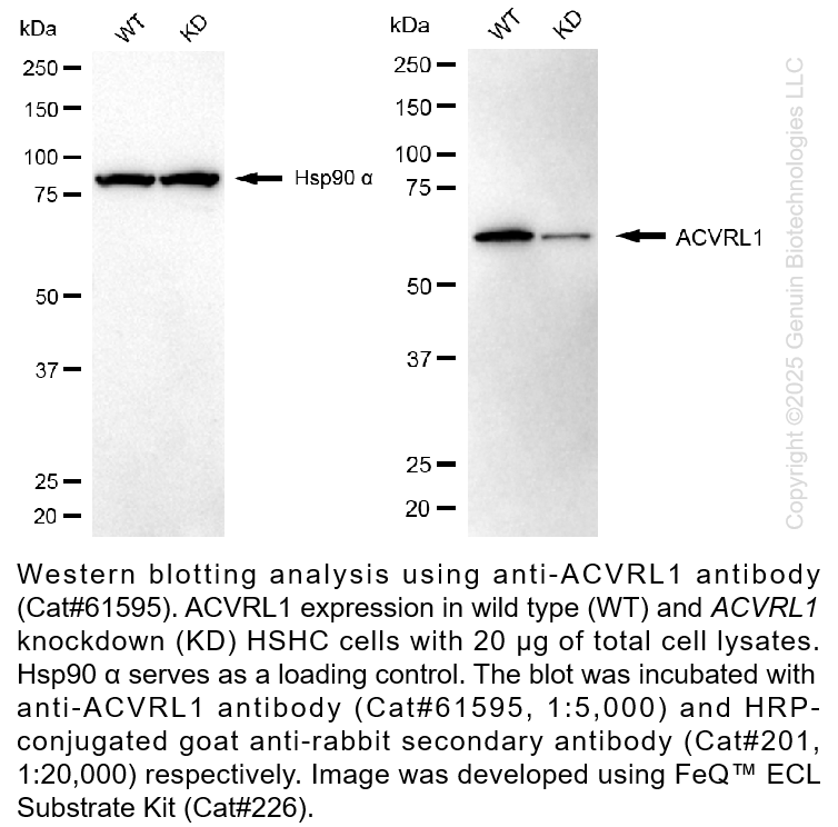 Thumbnail: KD-Validated Anti-Activin A Receptor Like Type 1 Rabbit Monoclonal Ab #61595