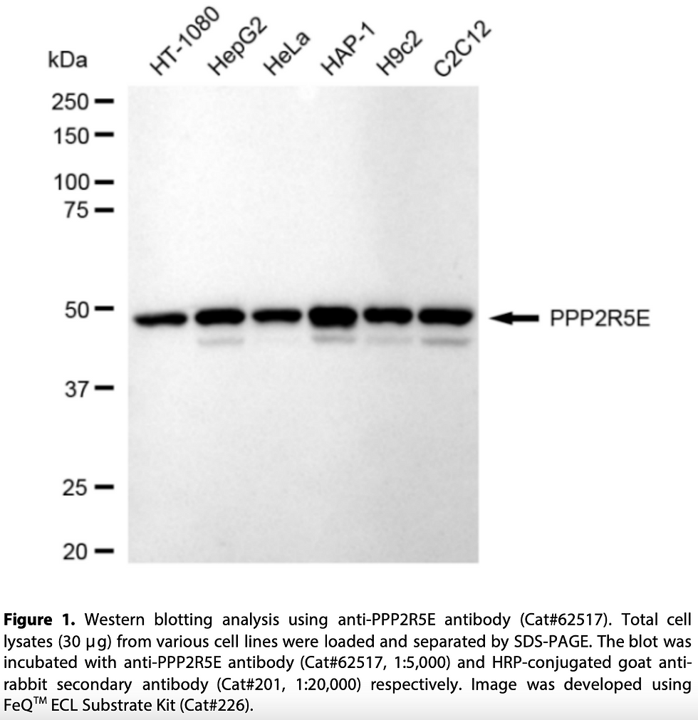 KD-Validated Anti-PPP2R5E Rabbit Monoclonal Ab#62517