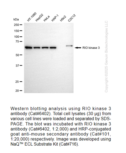 Mabs Rio RIO Kinase 3 Mouse mAb #6402 | GenuIN Biotech