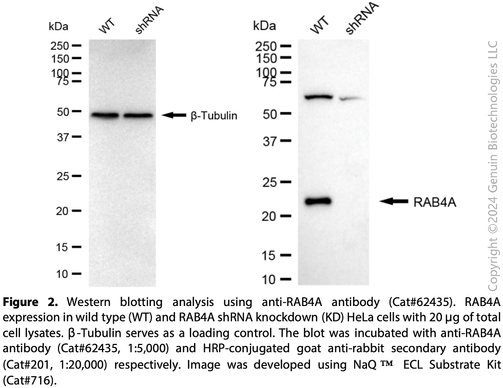 Thumbnail: KD-Validated Anti-Rab4 Rabbit Monoclonal Ab#62435