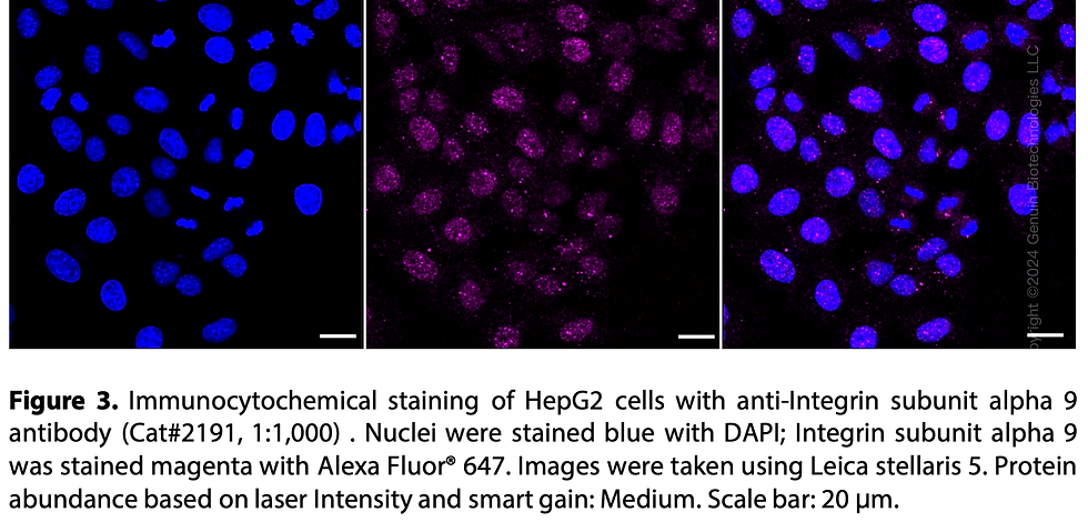Thumbnail: Anti-Integrin Alpha 9 Rabbit mAb #2191