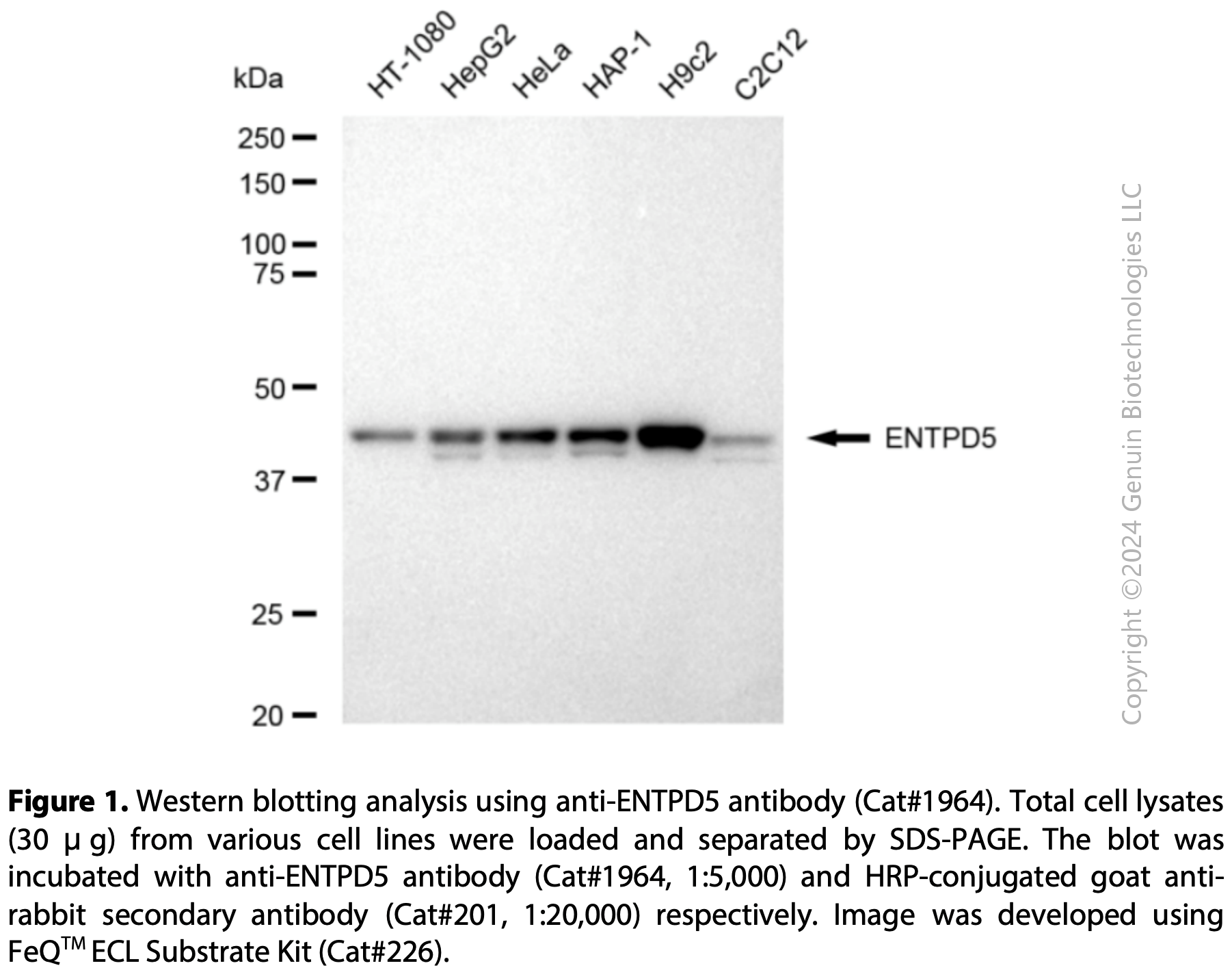 Anti-ENTPD5 Rabbit mAb #1964