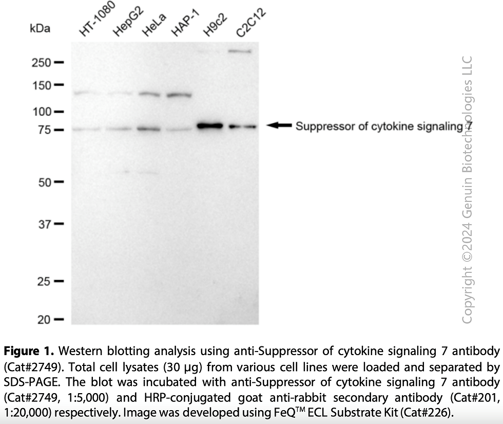 Thumbnail: Anti-Suppressor Of Cytokine Signaling 7 Rabbit mAb #2749