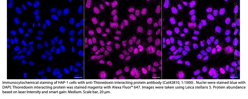 Thumbnail: Anti-TXNIP Rabbit mAb #2810