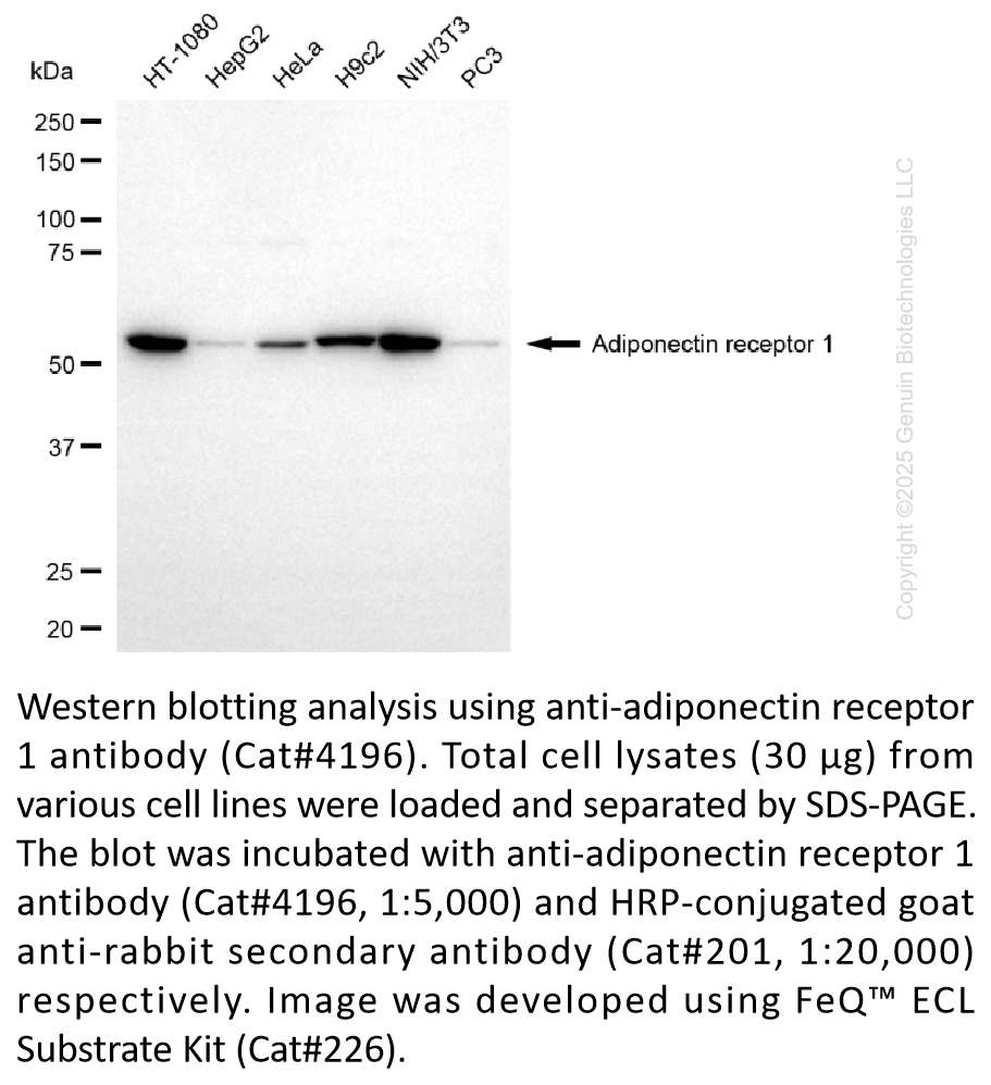 Anti-Adiponectin Receptor 1 Rabbit Monoclonal Ab #4196