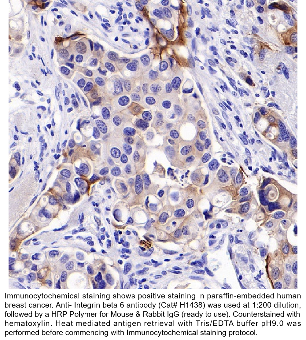 Anti-Integrin beta 6 Rabbit Monoclonal Ab #H1438