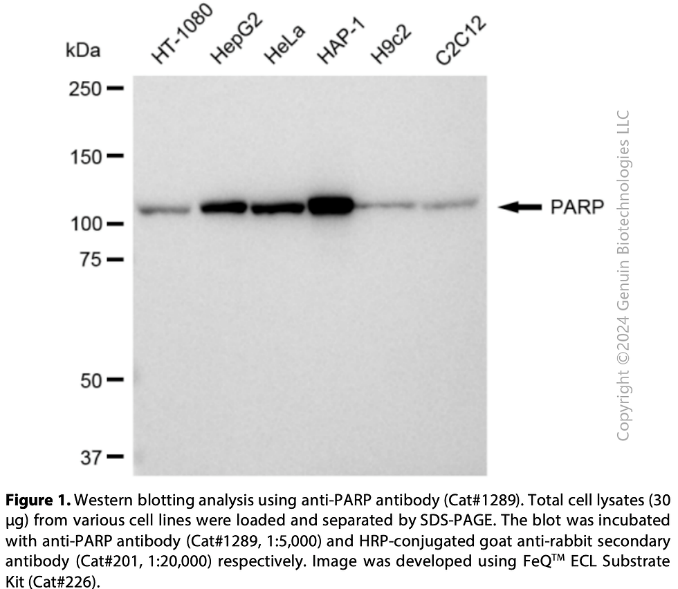 Thumbnail: Anti-PARP Rabbit mAb #1289