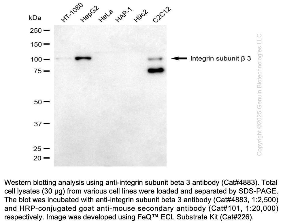 Anti-ITGB3 Mouse Monoclonal Ab #4883