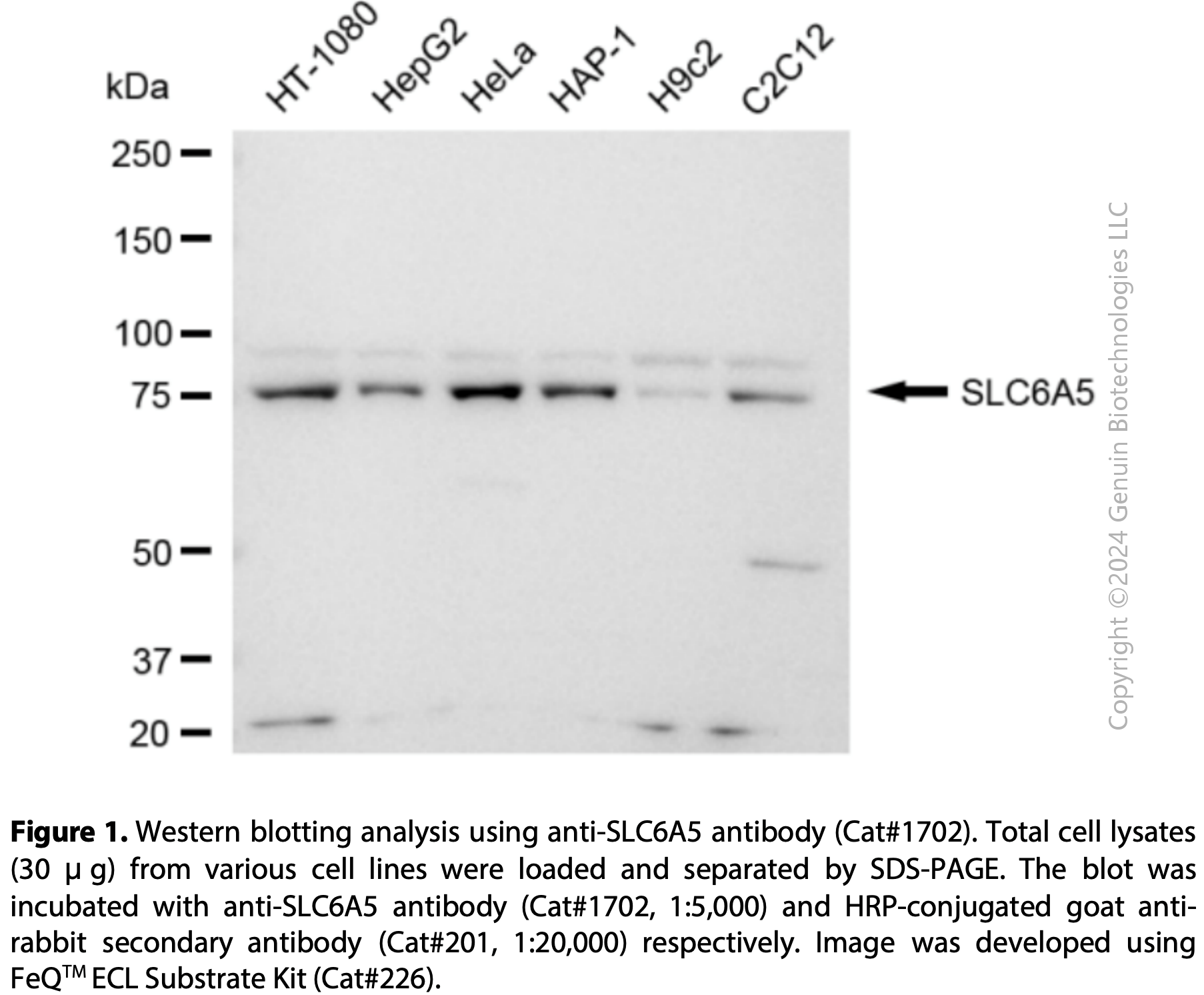 Anti-SLC6A5 Rabbit mAb #1702