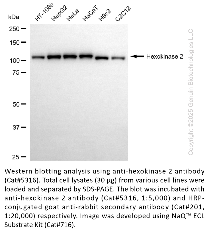 Anti-Hexokinase 2 Rabbit Monoclonal Ab #5316