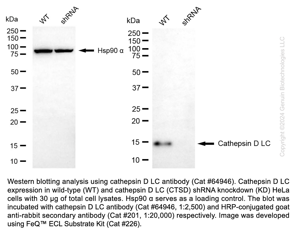 Thumbnail: KD-Validated Anti-Cathepsin D LC Rabbit pAb #64946