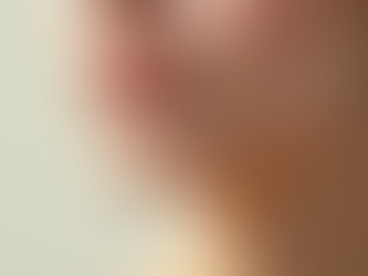 Transformative Sculptra Results Overview: A Journey to Lasting Beauty