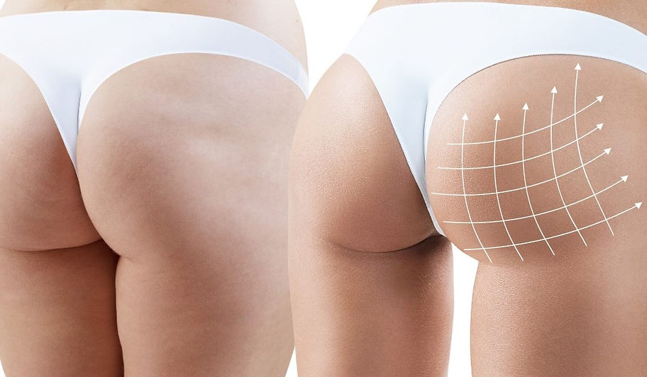 brazilian butt.jpg
