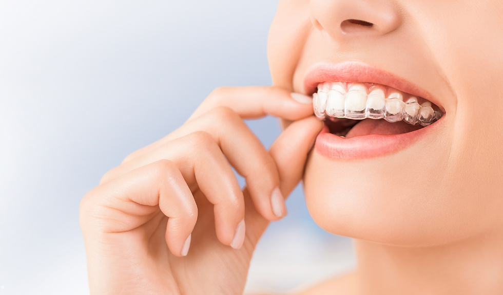 Invisalign2
