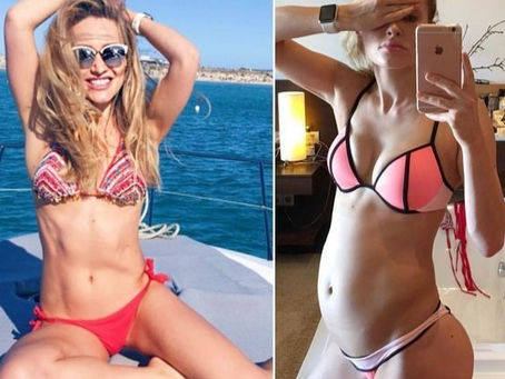 Bloated, Heavy & Uncomfortable? The Real PCOS Bloating Triggers No One Talks About