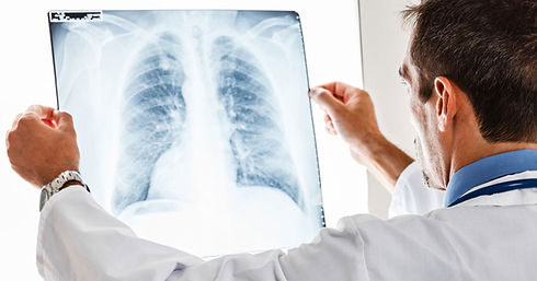 MESOTHELIOMA _ LUNG CANCER.jpeg