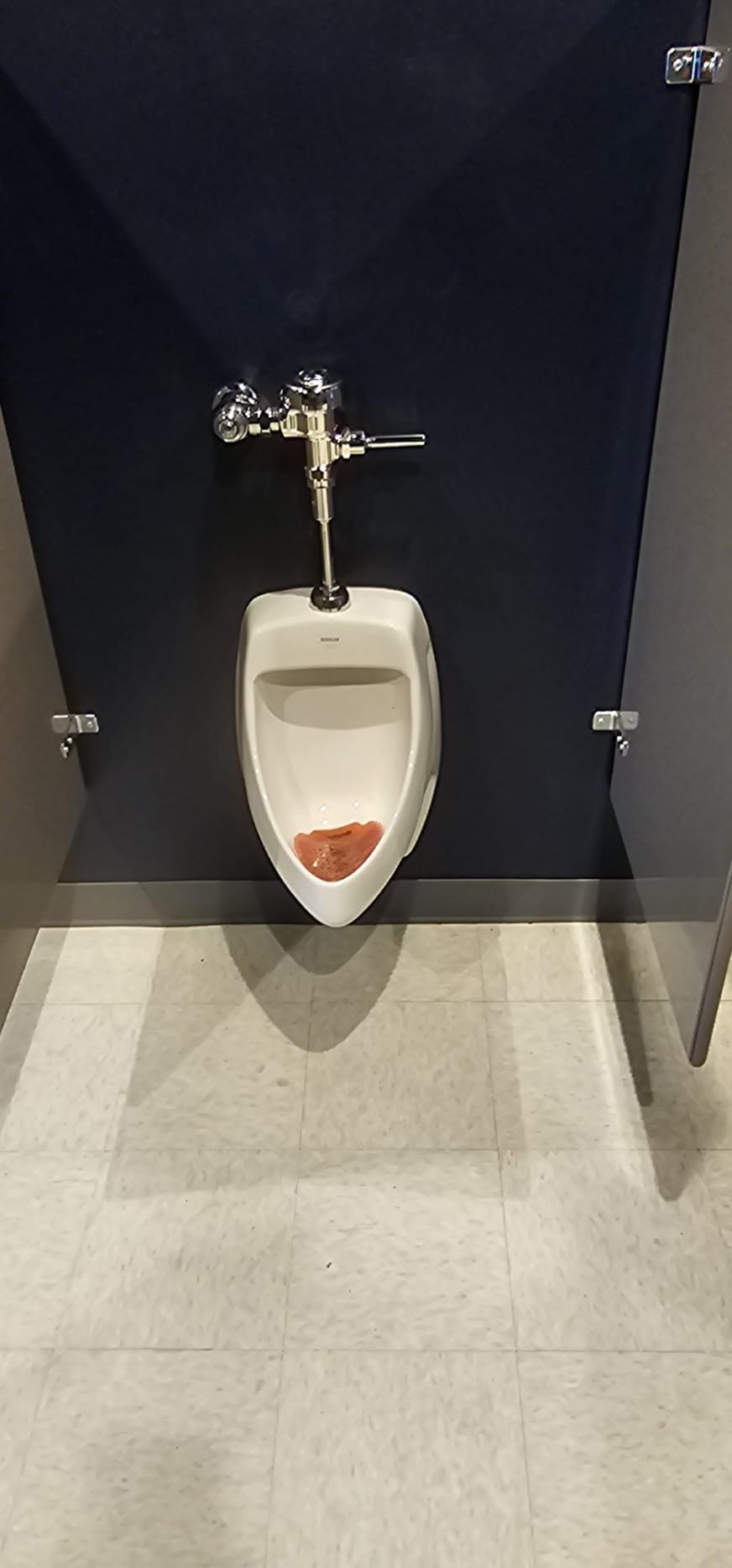 Image depicting bathroom shower repair, relevant to commercial bathroom equipment maintenance and commercial bathroom mold repair estimates. Showers are a common area for mold growth, requiring professional assessment and repair services to ensure a safe and hygienic environment.