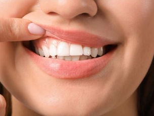 טיפולי חניכיים במרפאת שיניים דנטל סנטר 