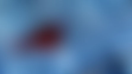 Blood stain on denim