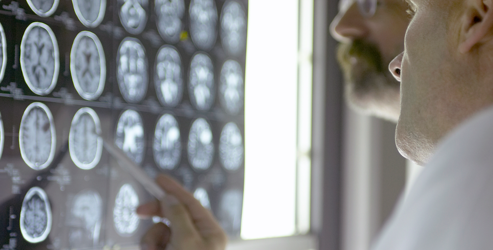 Imaging of Brain Injuries on a Light Box Being Reviewed