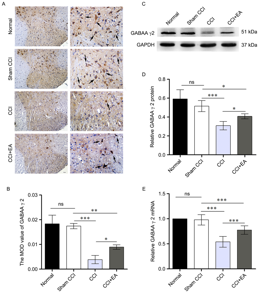 Figure 4. EA increased the expression of GABAA receptor γ2 subunit (n=5). (A) The GABAA receptor γ2 subunit was stained in an immunohistochemistry study (the left side of the column: Scale bar, 50 μm; the right side of the column: Scale bar, 20 μm). (B) The bar graph indicated the quantitative GABAA receptor γ2 subunit positive regions in four groups. (C) Western blot analysis of GABAA receptor γ2 subunit protein in L4‑6 presented a marked reduction. GAPDH was used as the loading control. (D) Summary data from western blotting experiments. (E) Quantification of relative GABAA receptor γ2 subunit mRNA levels in CCI rats. *P<0.05, ***P<0.001 as indicated; ns, not significant. EA, electro‑acupuncture; CCI, chronic constriction injury;