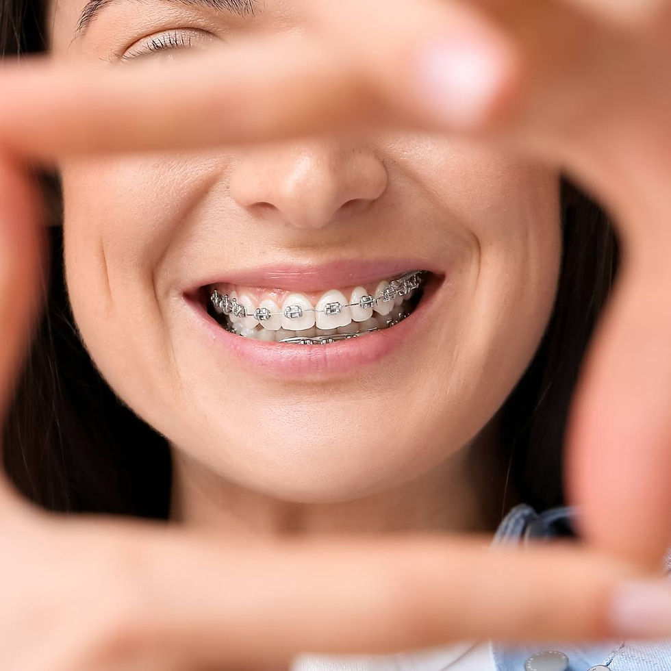 Limpieza Dental Profesional: La base de la Odontología Preventiva