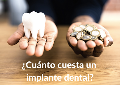 Comparativa de preus d'un implant dental