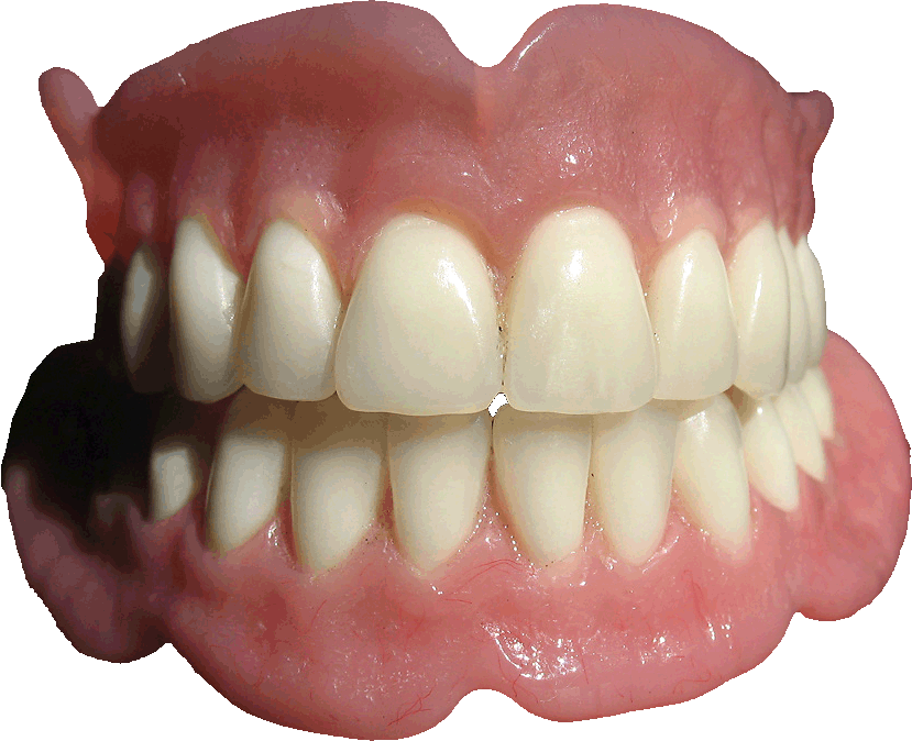 Dentaduras Totales