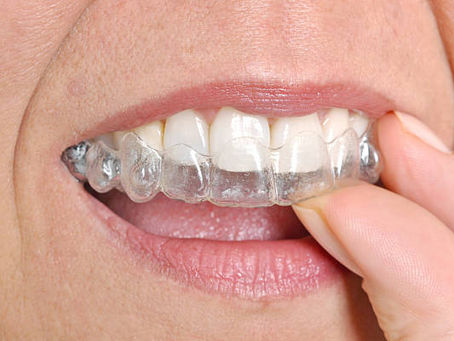 Smile Perfected: Top Orthodontics in Riyadh