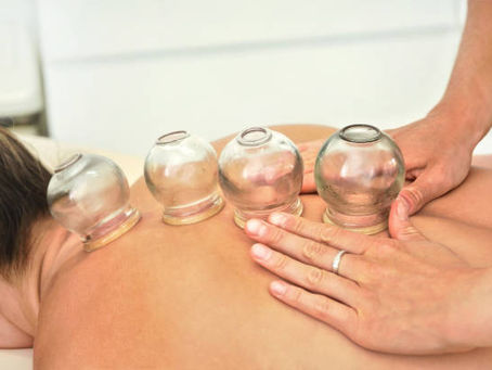 Revitalize with Cupping: Top Therapy in Riyadh