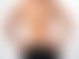 Gynecomastia Surgery in Riyadh: Safe and Effective Solutions