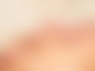 Unlock Wellness with Cupping Treatment in Riyadh