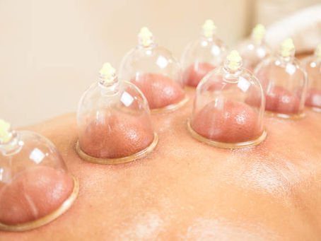 Unlock Wellness with Cupping Treatment in Riyadh