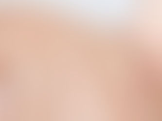 Unveiling Skin Health: Dermoscopy Mole Evaluation in Riyadh