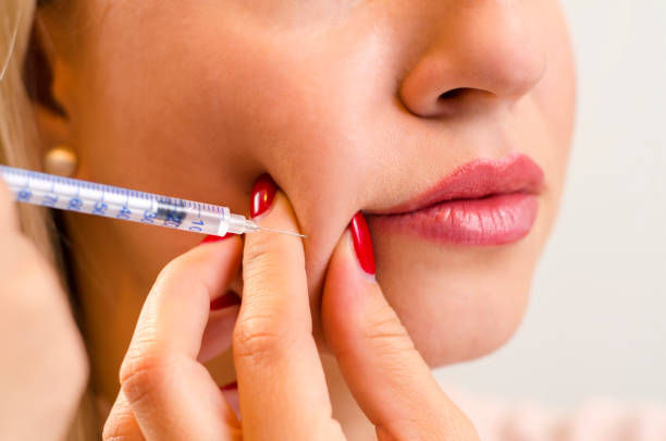 Sculpting Beauty: Unveiling the Magic of Liposonix in Riyadh