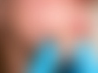 Unlock the Secrets: Comprehensive Dermoscopy Mole Evaluation