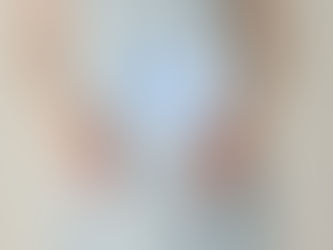 Unlock a Healthier You with Gastric Sleeve Surgery in Riyadh