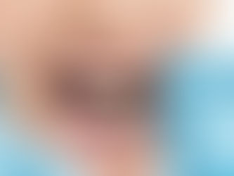 Transform Your Smile with Dental Implants in Riyadh