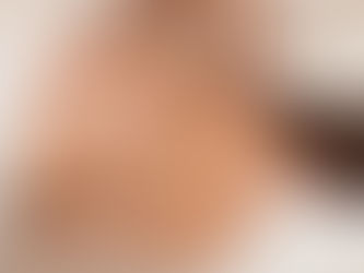 Unlock Wellness: Discover Cupping Treatment in Riyadh