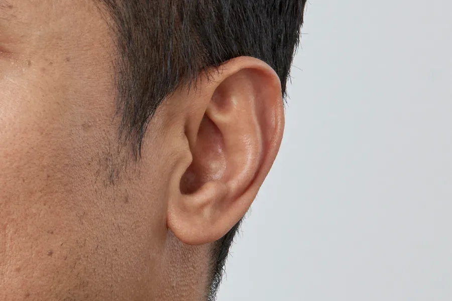 Front view of IIC hearing aid