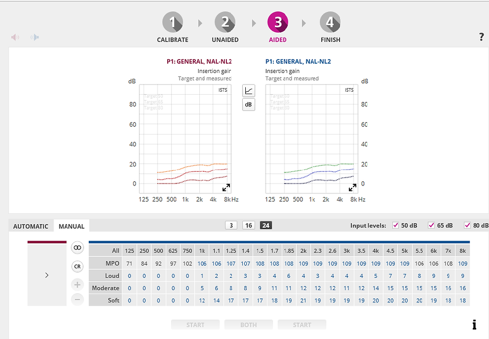 Audiologist's software screen.