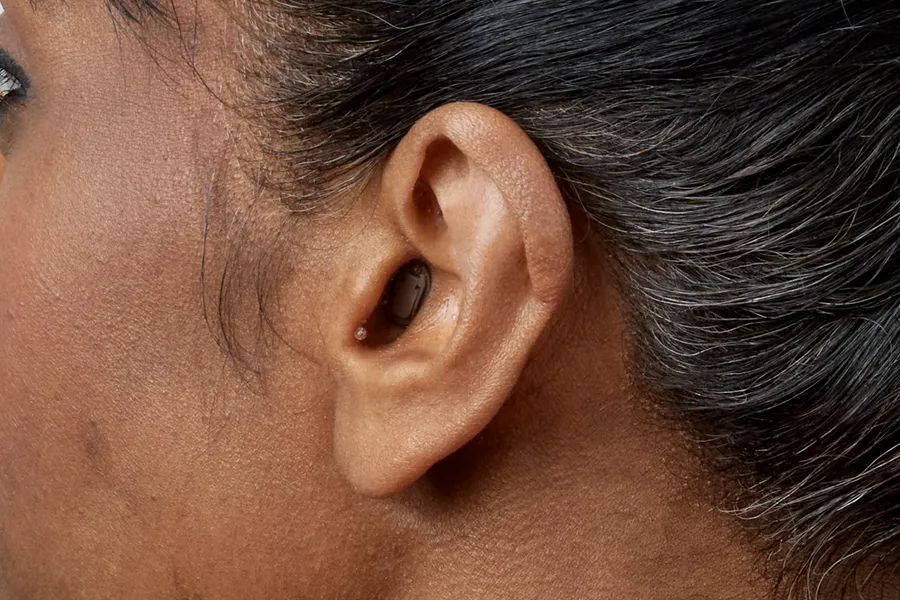 Rear view of CIC hearing aid