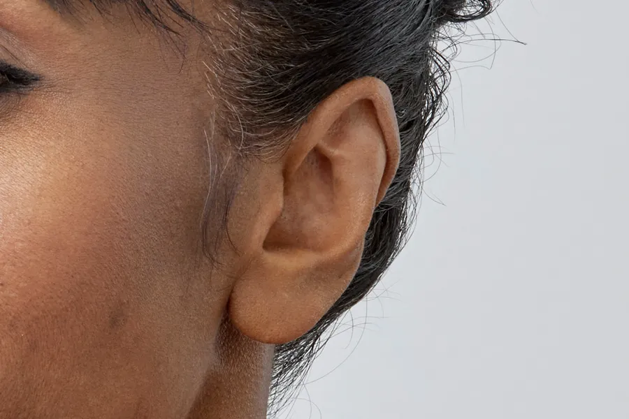 Front view of CIC hearing aid