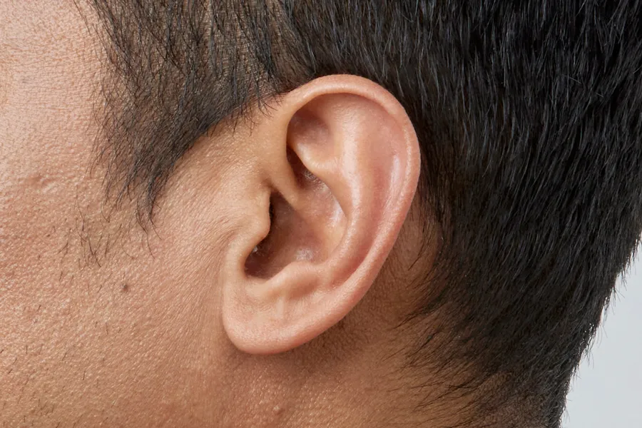 Side view of IIC hearing aid