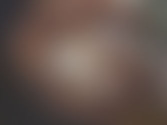 The Facts you won’t refuse about Primary Biliary Cirrhosis Drugs Market