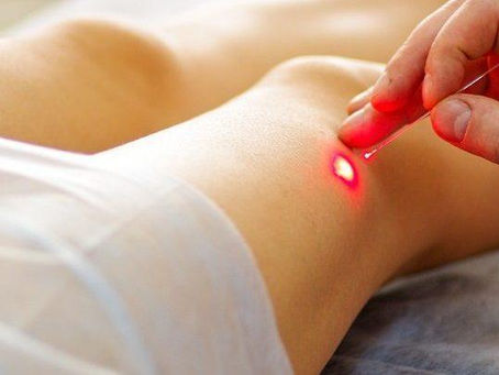 The Next Big Thing in Varicose Vein Treatment Devices Market