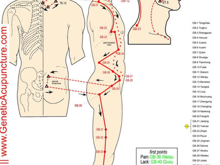 Acupuncture for Sciatica